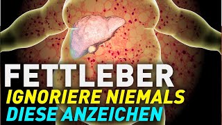 Fettleber Diese Symptome NIEMALS ignorieren [upl. by Nauqyaj]