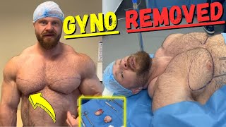 They removed eggsized glands from his chest gyno surgery explained [upl. by Arramat163]