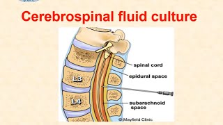 Cerebrospinal fluid culture  dr Ismail [upl. by Anizor371]