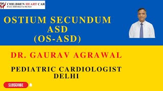 Ostium Secundum Atrial Septal Defect OSASD Dr Gaurav Agrawal Pediatric Cardiologist New Delhi [upl. by Artim]