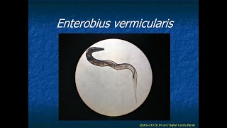 Enterobius vermicularis [upl. by Rina]