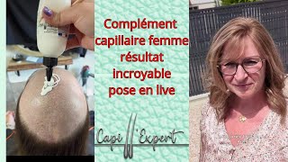 Complément Capillaire femme résultat incroyable [upl. by Oiram]