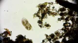 Stylonychia Wimpertierchen  Ciliate  Ciliophora  Ciliata  microorganisms under microscope [upl. by Ecadnarb339]