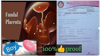 fundal anterior placenta baby gender mothervlogs57 [upl. by Trueman909]