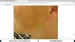 Chp41 Pharma Lippencott  Drugs used to treat Pigmentation Disorders  Dr Asif Lectures [upl. by Danielson]