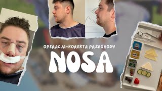 OPERACJA NOSA đź‘ PRZED I PO  korekta przegrody nosowej w Turcji [upl. by Griffin]