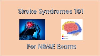 Stroke Syndrome Review 101 for NBME exams [upl. by Ojybbob]