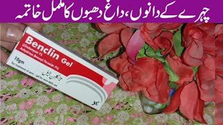 how to remove acne scars pimple marks dark spots in 1 week Bencline Gel  Alia Beauty plus [upl. by Massey]