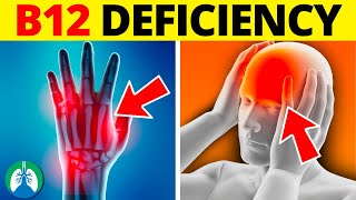 ⚠️ Top 10 Symptoms of Vitamin B12 Deficiency That You MUST Know [upl. by Kruger]