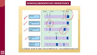 Hematology  2  U1L37  Hemoglobin electrophoresis [upl. by Amehsat]