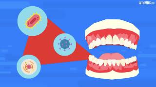 Understanding Tooth Abscesses Causes Treatment Prevention [upl. by Agnola]