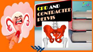 Cephalo Pelvic Disproportion and Contracted Pelvis  Full Explanation in Hindi  By NG Medicals [upl. by Squires]