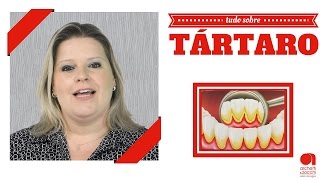 Tartaro Como acabar com o Tártaro nos Dentes [upl. by Annonyw719]