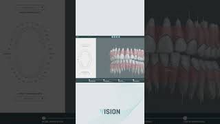 Dental CBCT Scan [upl. by Milde]