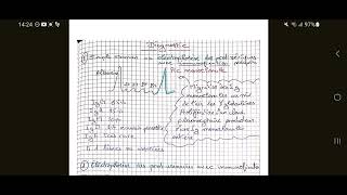 LES GAMMAPATHIES MONOCLONALES [upl. by Otrebor986]