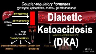 Diabetic Ketoacidosis DKA Pathophysiology Animation [upl. by Nadler]