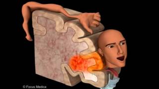 Primary Motor Cortex  Neuroanatomy [upl. by Tehc]