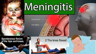 Meningitis in Children  Most Deadly infection for Children [upl. by Agueda]