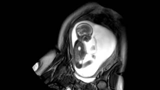 Foetal Development Unborn Baby Movement at 24 Weeks  WIRED [upl. by Ellenhoj784]