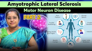 Amyotrophic Lateral Sclerosis  Motor Neuron Disease  Part 2  DR A VENI MD DM NEURO [upl. by Tyne]