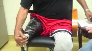 Amputee dons Stan Patterson NPS Elevated Vacuum Above Knee Socket Tutorial [upl. by Kresic]