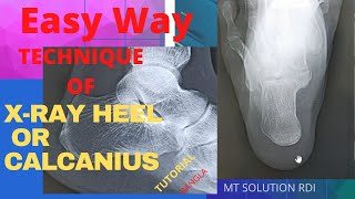 X ray heel or calcanius axial amp lat view  ep 11 Bangla tutorial review  positioning of heel [upl. by Judie]