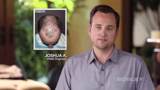 Bosley Hair Transplant Patient Review  Josh A [upl. by Berfield]