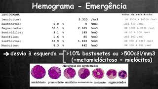 Avaliação rápida do hemograma [upl. by Sidnac459]