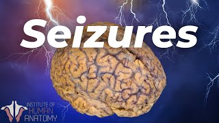 Whats Actually Happening During a Seizure [upl. by Aromat62]