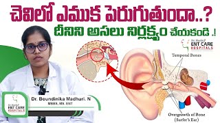 చెవిలో ఎముక పెరుగుతుందా  What is Otosclerosis  Hearing Loss  Dr Harika ENT Care Hospital [upl. by Vaclav151]