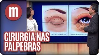 Mulheres  Saúde Cirurgia nas pálpebras 290316 [upl. by Zsazsa]