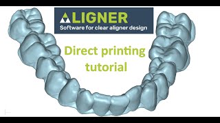 Direct printing clear aligners  Deltaface orthodontic software tutorial [upl. by Anaed]