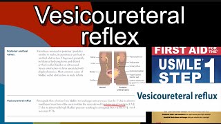 Vesicoureteral reflex in HindiUrdu by first aid for USMLE step 1 [upl. by Caro655]