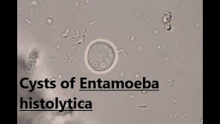 Cysts of Entamoeba histolytica  Saline wet mount  labmedicine9265 [upl. by Der]