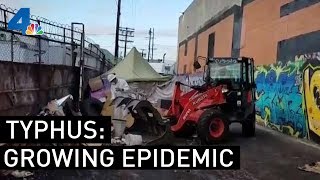 Typhus Epidemic Worsens in Los Angeles  NBCLA [upl. by Urbana138]