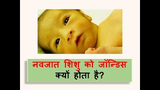 Neonatal Jaundice l Polio l causes l symptoms l treatment l ayurveda [upl. by Heather]