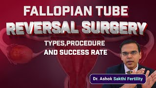 Fallopian Tube Reversal surgery  Fallopian Tubes types  Procedure and success rate [upl. by Derfiniw]