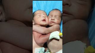 twins brothers shorts twins viral vedio brothers nicu [upl. by Kitarp]