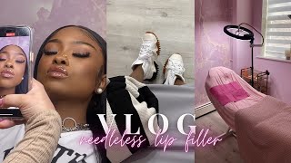 Come With Me To Get Needleless Lip Fillers Vlog  Review [upl. by Tibbs606]