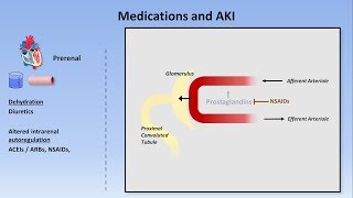 Acute Kidney Injury Part 13  Definitions and Etiologies [upl. by Nysilla239]