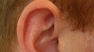 Determine If Ear Cartilage Is Infected  Ear Problems [upl. by Nolie]