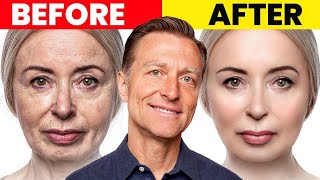 The Ultimate Face Transformation–Dr Bergs Best Remedy for Dry Skin and Wrinkles [upl. by Etta413]