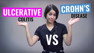 Ulcerative Colitis vs Crohns disease Nursing  NCLEX Review  Christina NP [upl. by Aneehsit336]