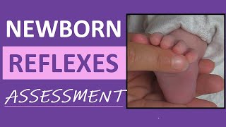 Newborn Reflexes Assessment Infant Nursing Pediatric NCLEX Review [upl. by Avehstab]