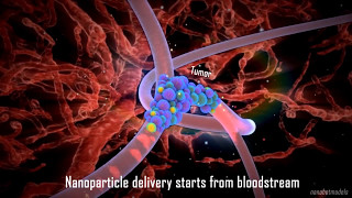 Gold Nanoparticles in Treatment of Prostate Cancer [upl. by Standush]