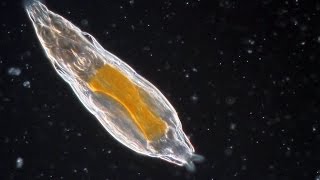 Bdelloid Rotifers so common yet so weird [upl. by Chauncey339]