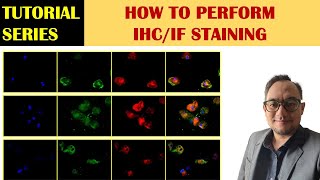 Immunofluorescence IF Staining Protocol for Adherent cells [upl. by Ynor]