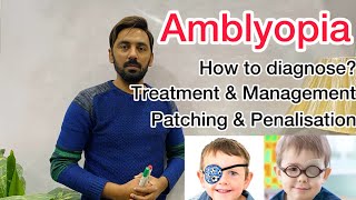 Amblyopia  Treatment amp management  patching amp penalisation [upl. by Isleana]