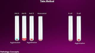 Blood group test procedure  slide  tube  microtiter plate  paper based [upl. by Euqina]