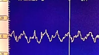 Fuel Pump State Of Health Assessment Alternative Method [upl. by Barth]